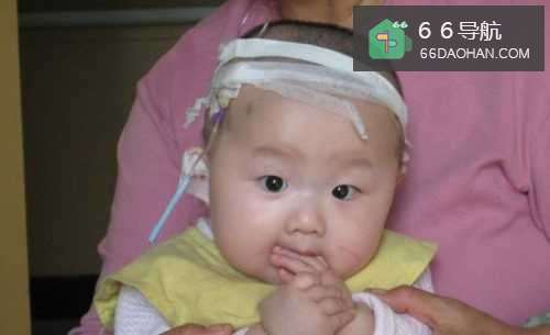 为什么现在的小孩那么容易生病?