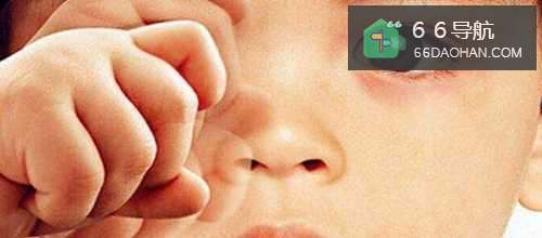 如何让孩子预防近视